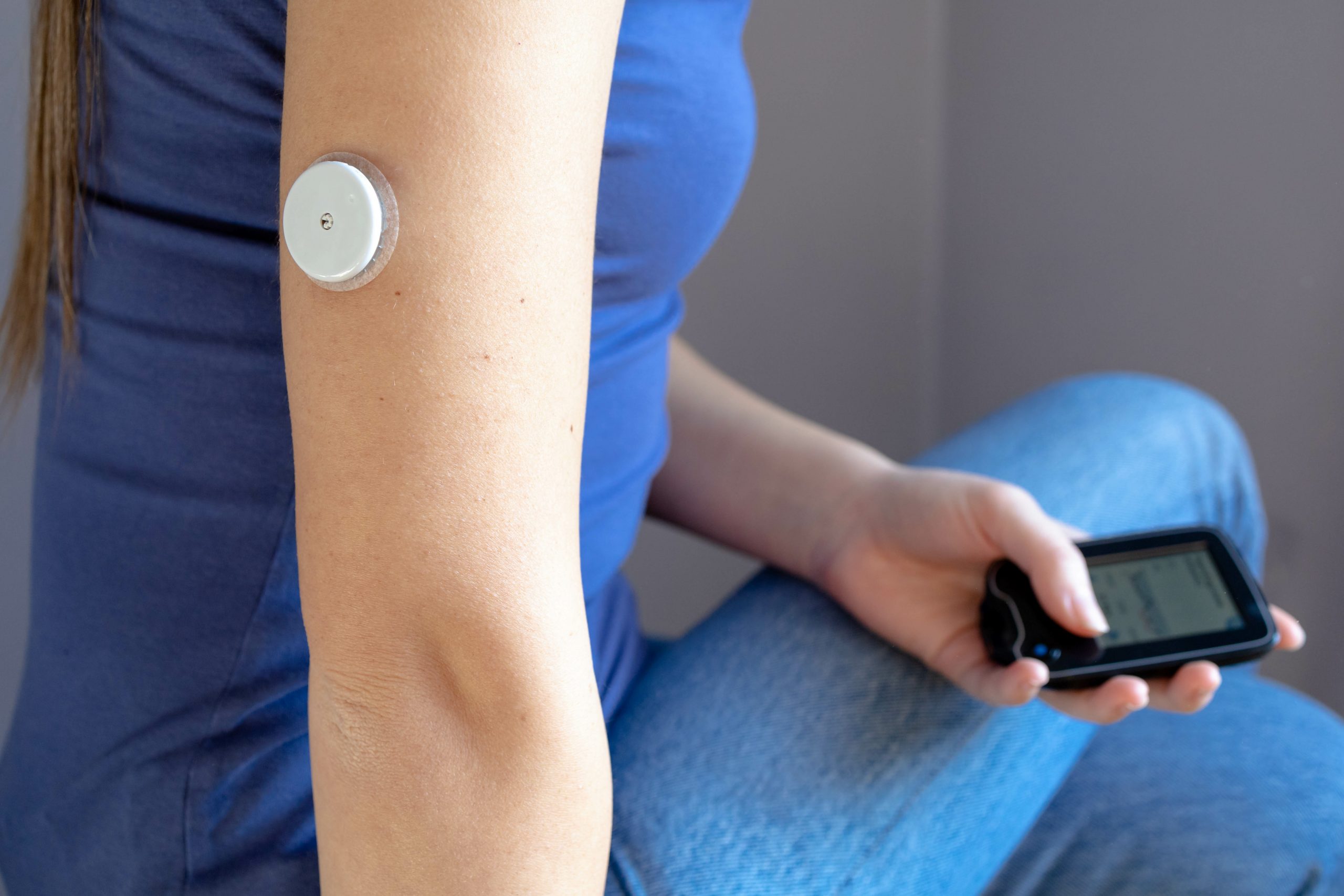 Girl sitting with flash glucose monitor, patch on her hand holding monitor